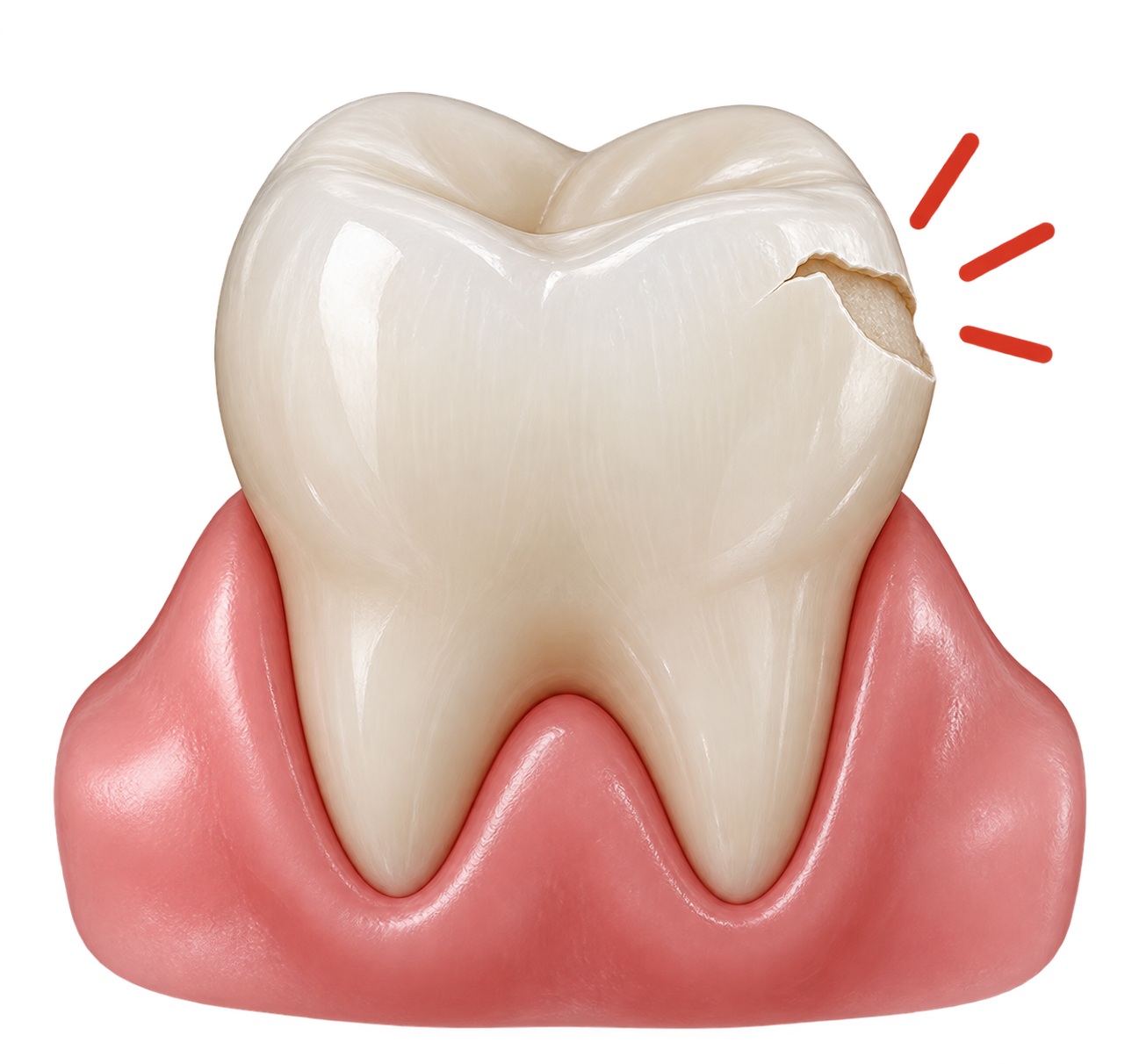 Common causes of a chipped tooth